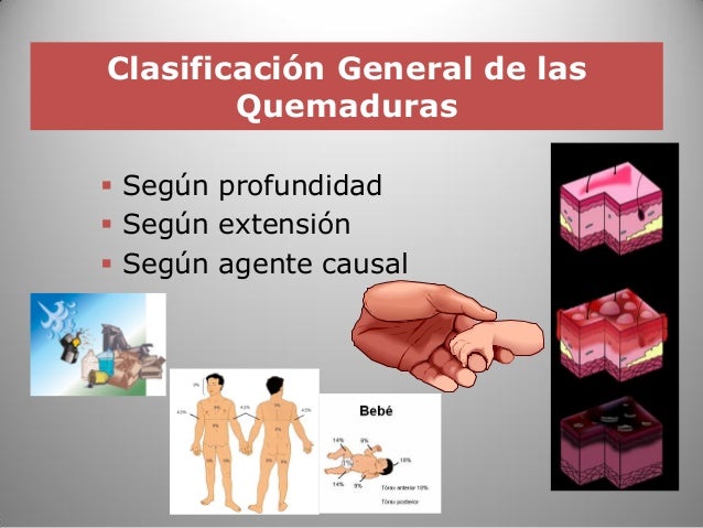 Protocolo quemaduras