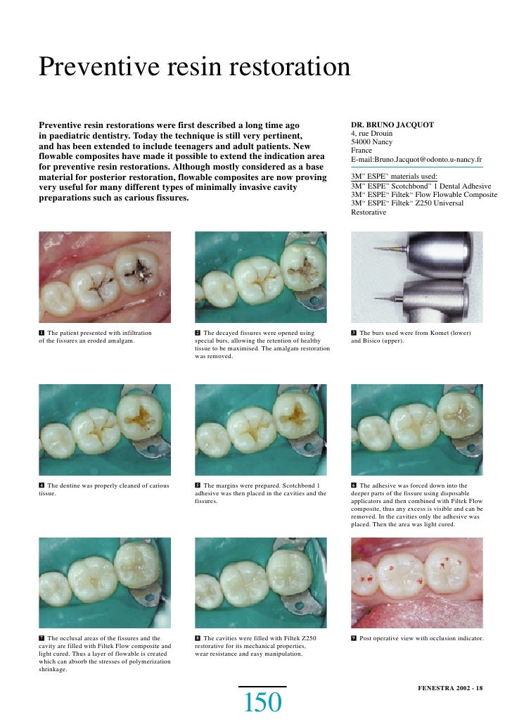 Preventive resin restoration