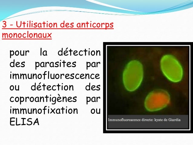 Au poisson les parasites long