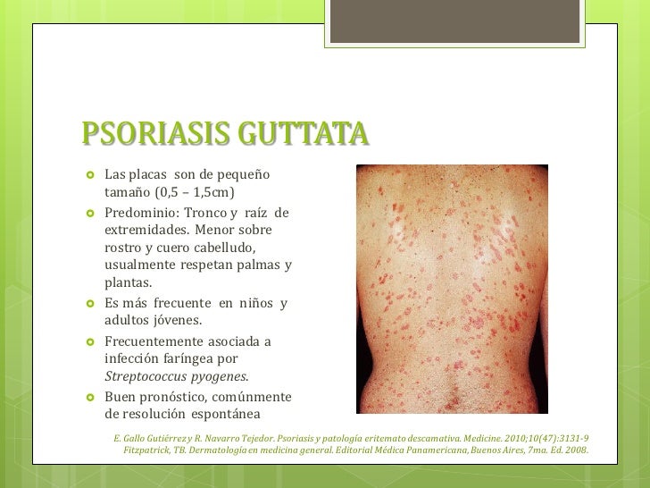 Atopichesky la dermatitis sobre los labios sexuales
