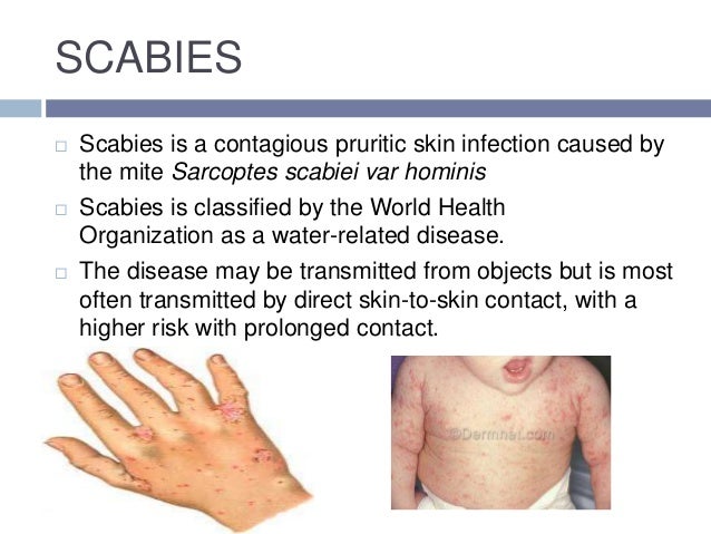 Rash on Fingers/Hand - Dermatology - MedHelp