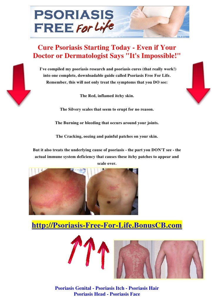 Psoriasis genital psoriasis itch - psoriasis hair Psoriasis genital psoriasis itch - psoriasis hair