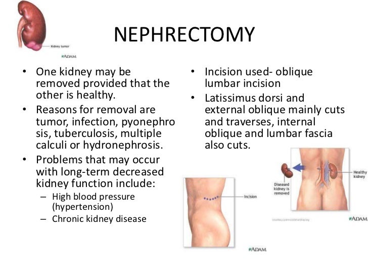 Kidney Transplant recovery