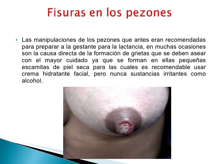 Las consecuencias negativas el aumento del pecho