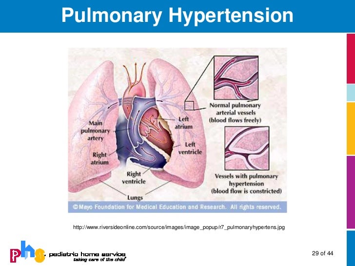 pulmonary hypertension treatment with sildenafil