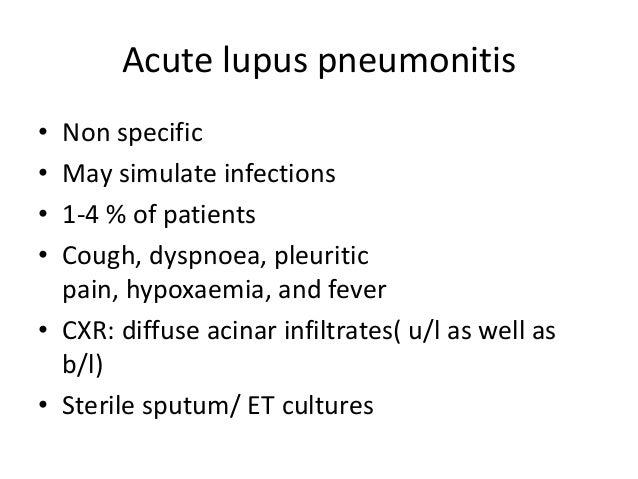 Neurontin For Lupus