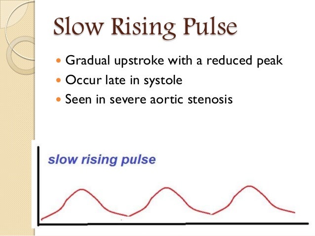 Pulse Abnormal Findings