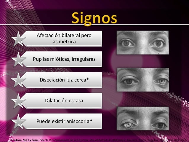 argyll robertson pupil differential diagnosis argyll robertson pupil differential diagnosis
