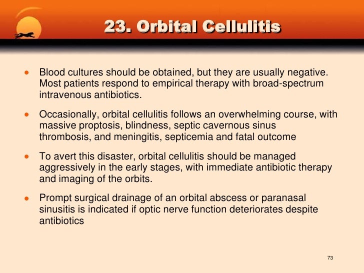 sinus infection headache forehead