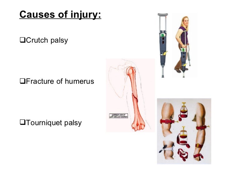 orthopedics.Radial nerve.(dr.baxtiar rasul)