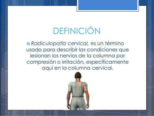 Cervical Zoster