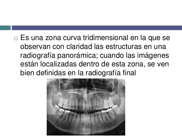 Radiografía panorámica