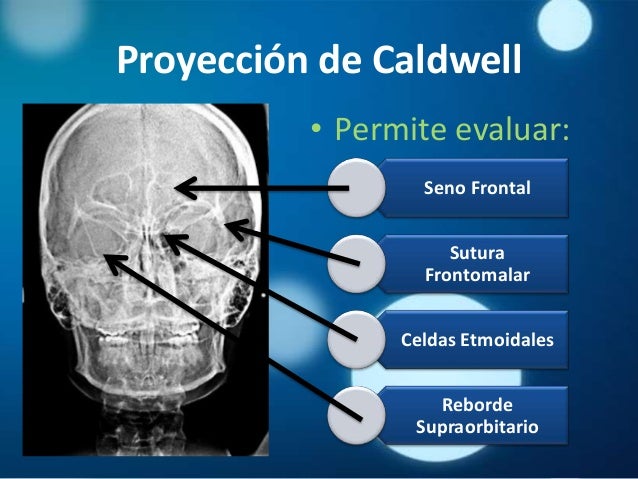 Radiografías en Cirugía Maxilofacial
