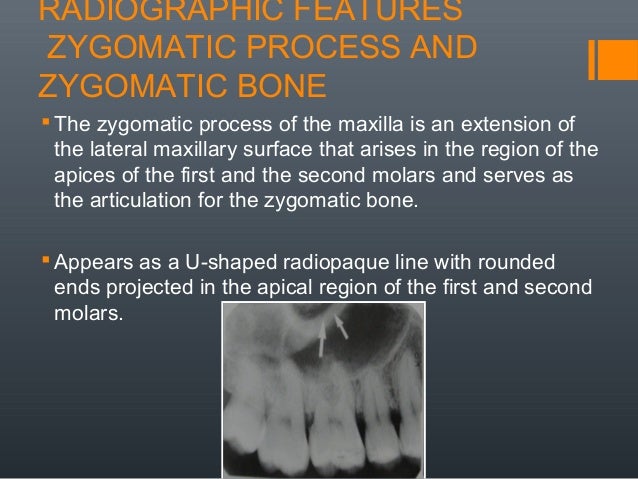 Radiographic anatomical landmarks By Dr. Armaan Singh