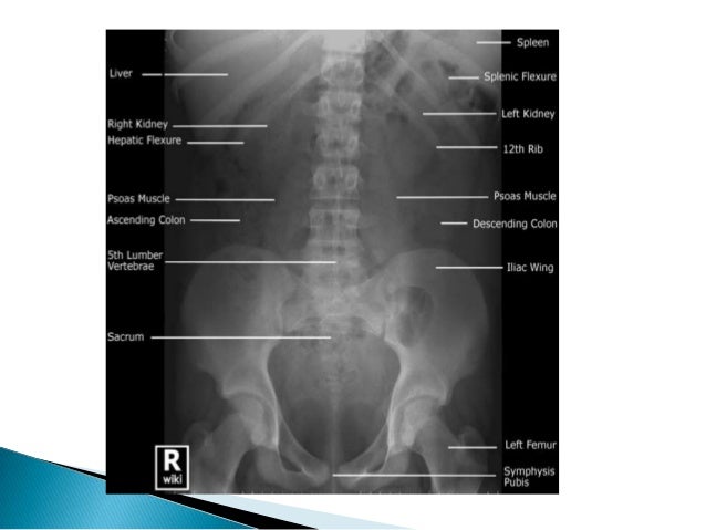 Radiographic anatomy of gastrointestinal tract