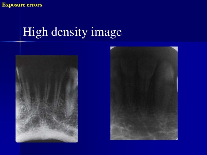 Radiographic errors and artifacts