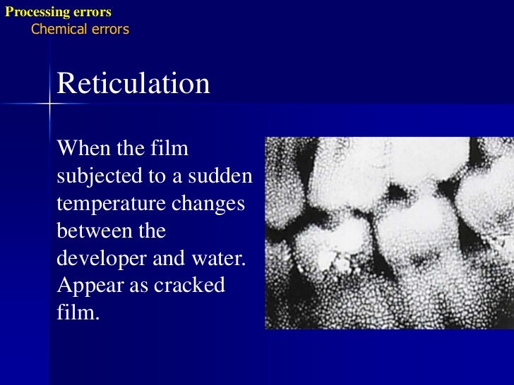 Radiographic errors and artifacts