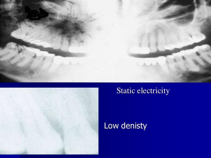 Radiographic errors and artifacts