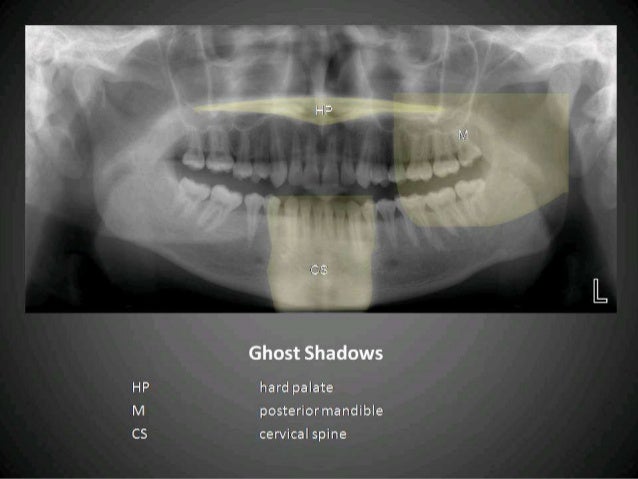 Radiographic interpretation