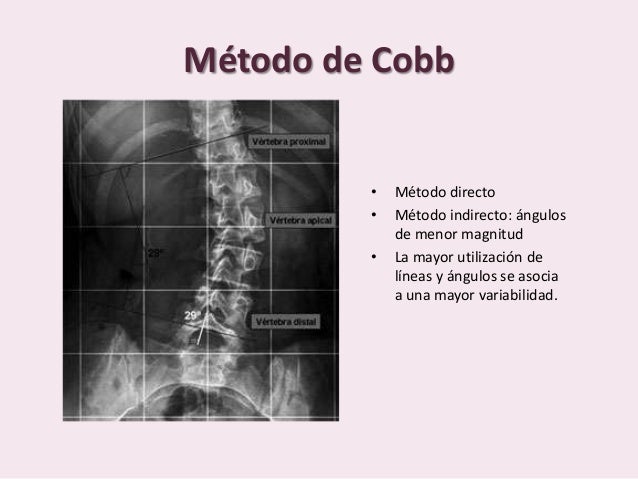 Radiología de la escoliosis
