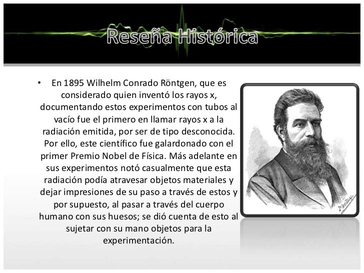 Inventos e inventores - Página 4 Radiologia-en-pacientes-politraumatizados-4-728