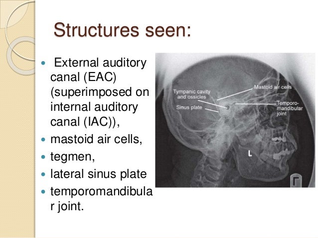 Sinus swollen tongue sphenoid contamination symptoms