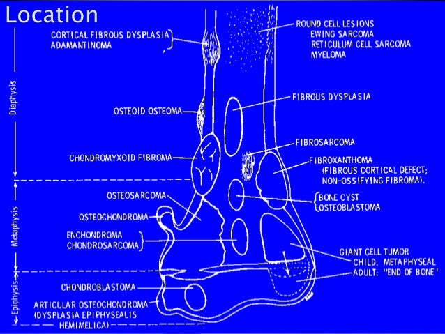 Lymphoma Radiology
