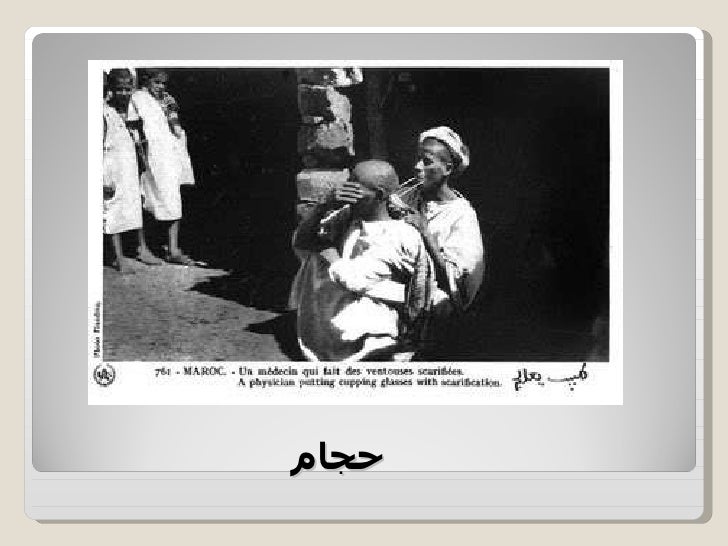 اضغط على الصورة لرؤيتها بالحجم الطبيعي