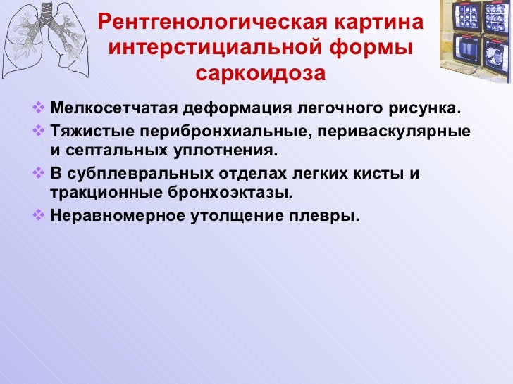 Рисунок деформация легких Рисунок деформация легких