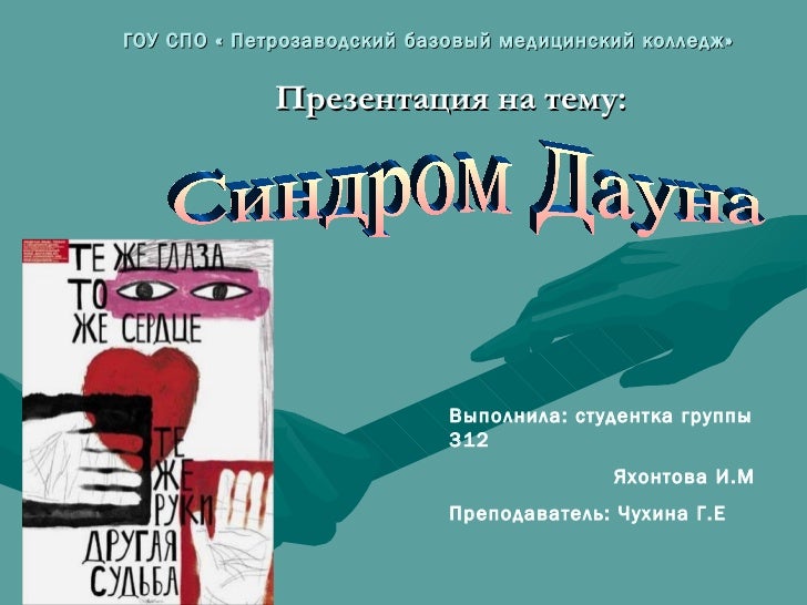 человека с синдромом дауна презентация человека с синдромом дауна презентация