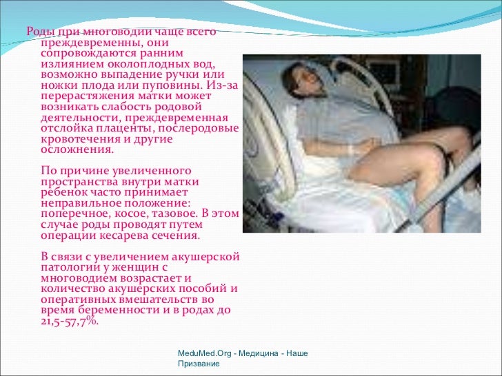 Вызвать роды препаратами Вызвать роды препаратами