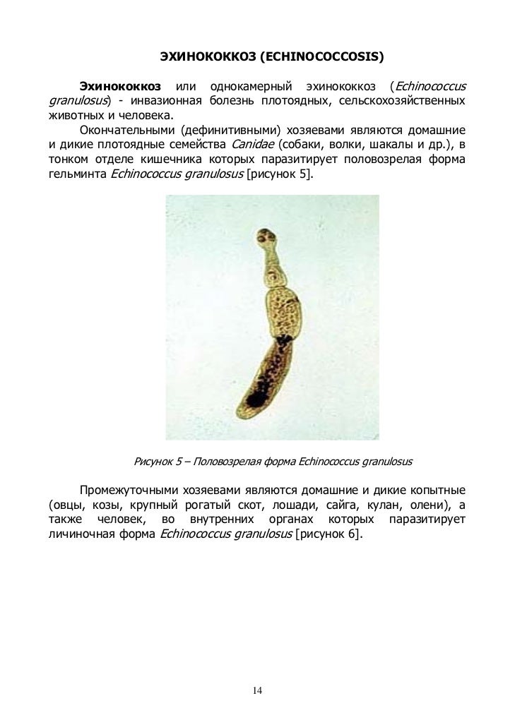 Эхинококкоз Однокамерный фото