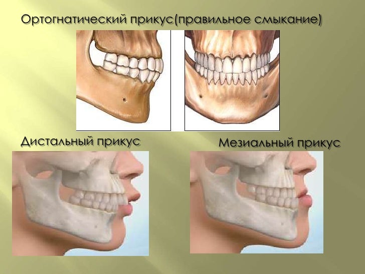 Аихризон Дерево любви как ухаживать в домашних условиях
