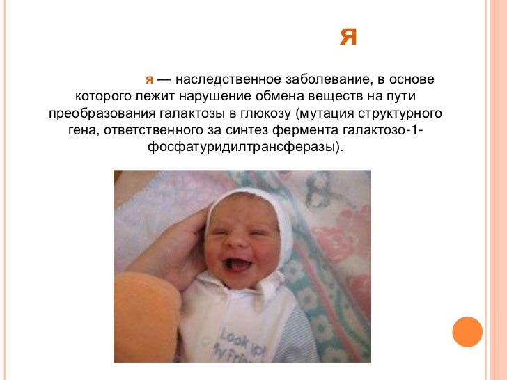 Гиповитаминоз D фото