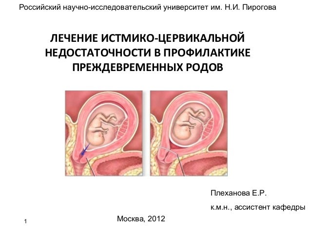 Улисс (James Joyce Ulysses) текст произведения Токсоплазма Википедия