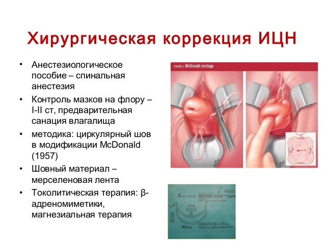 Что такое зев в гинекологии