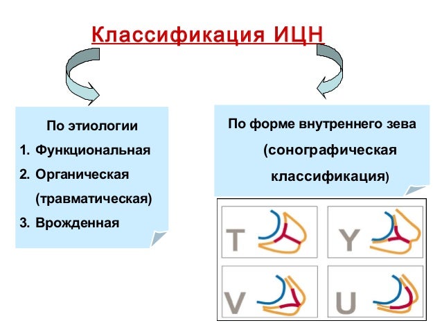 Как рассчитать срок беременности точно все Как найти человека по фамилии, имени и году рождения