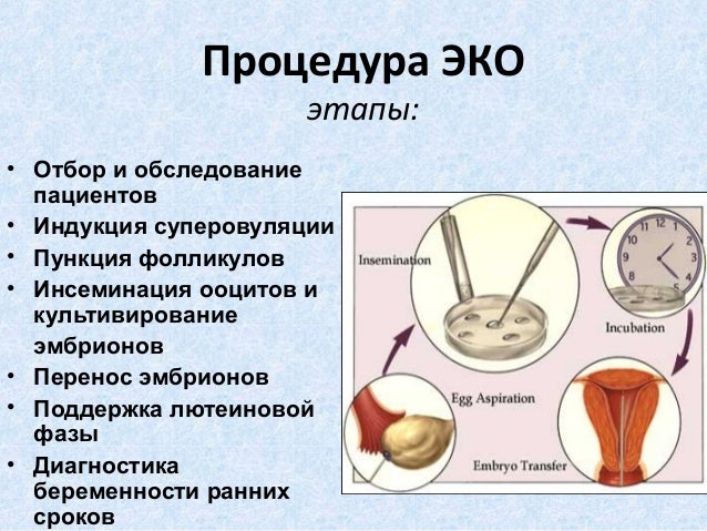 Все об эко поэтапно Все об эко поэтапно