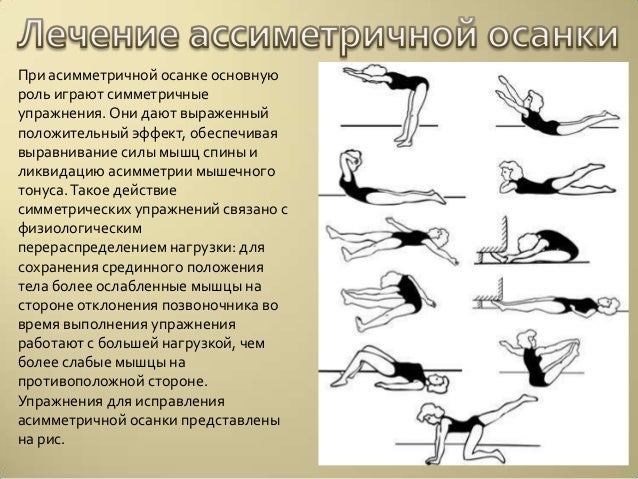 Исправить осанку в домашних условиях