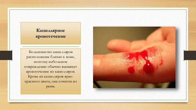 Чем в домашних условиях остановить кровь Чем в домашних условиях остановить кровь