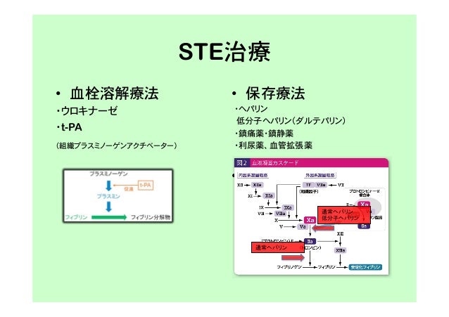 ウロキナーゼ (ウロキナーゼ) JapaneseClass.jp