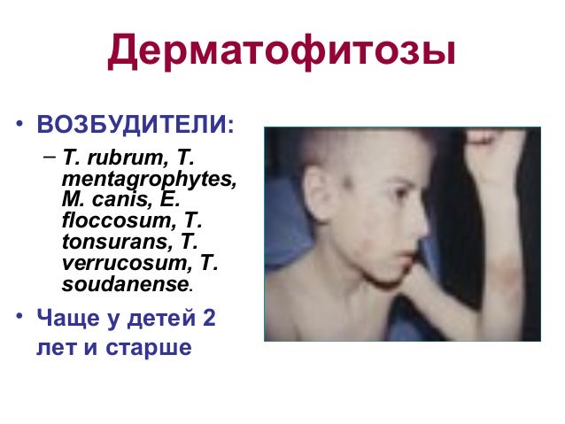 Содрали родинку к какому врачу обратиться
