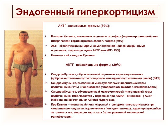 Симптомы и лечение аденомы гипофиза. Последствия заболевания Симптомы и лечение аденомы гипофиза. Последствия заболевания
