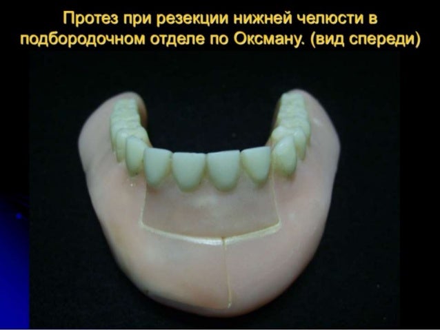 Боль в пояснице когда чихаешь Боль в локтях: все причины болей в локтях