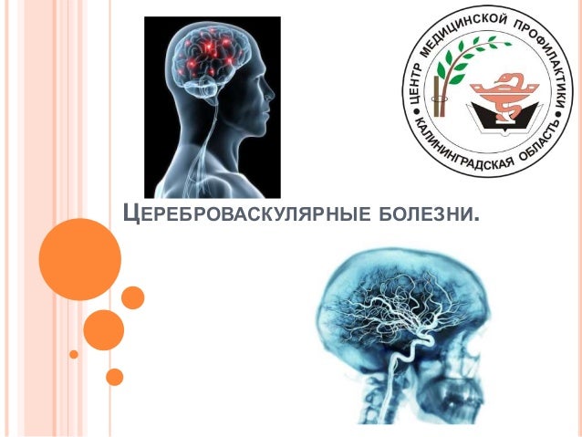 Головная боль в висках чем помочь
