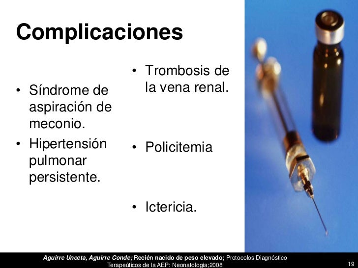 Las venas en los pies el tratamiento los modos públicos del tratamiento
