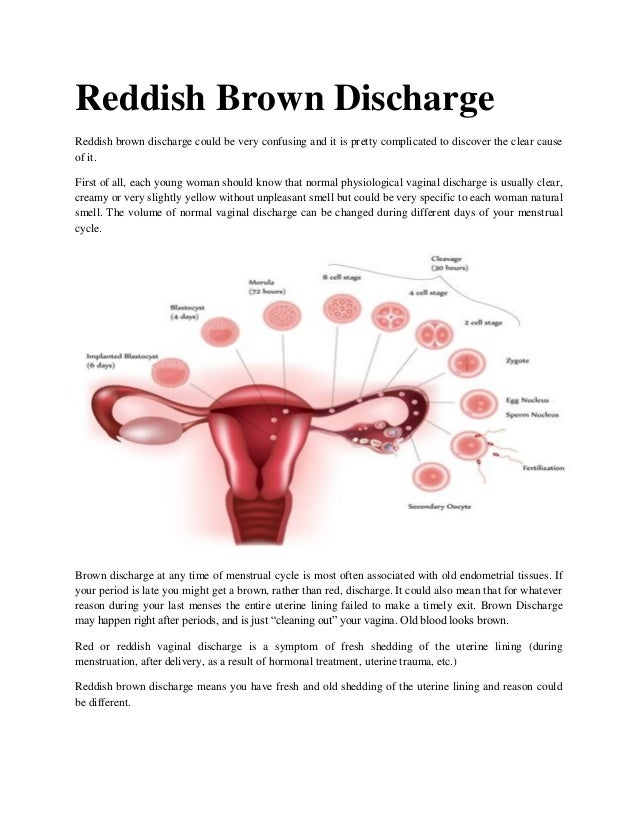 Brownish discharge from the vagina