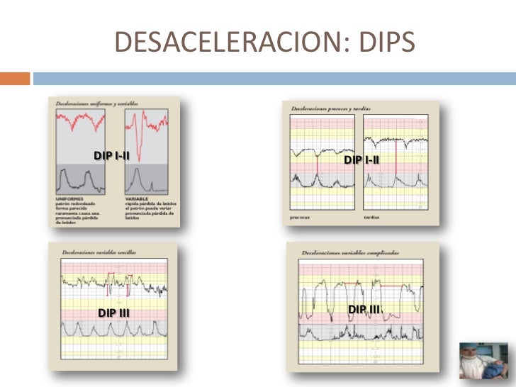 REGISTRO CARDIOTOCOGRÁFICO