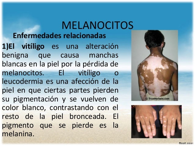 Meladerm la crema que blanquea comprar