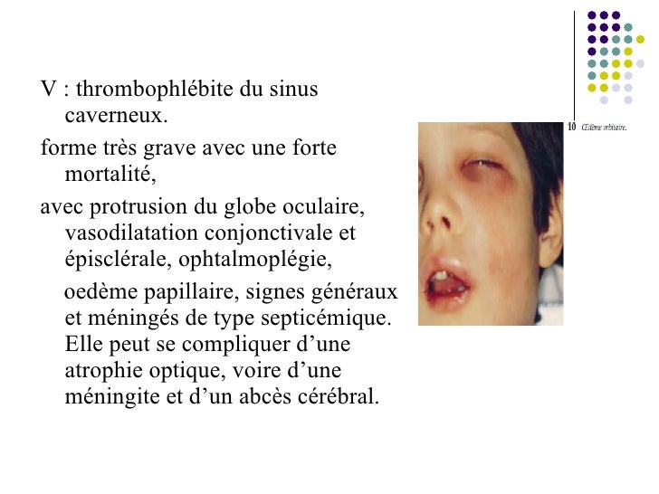 Relation Pathologique Oeil Dent Relation Pathologique Oeil Dent